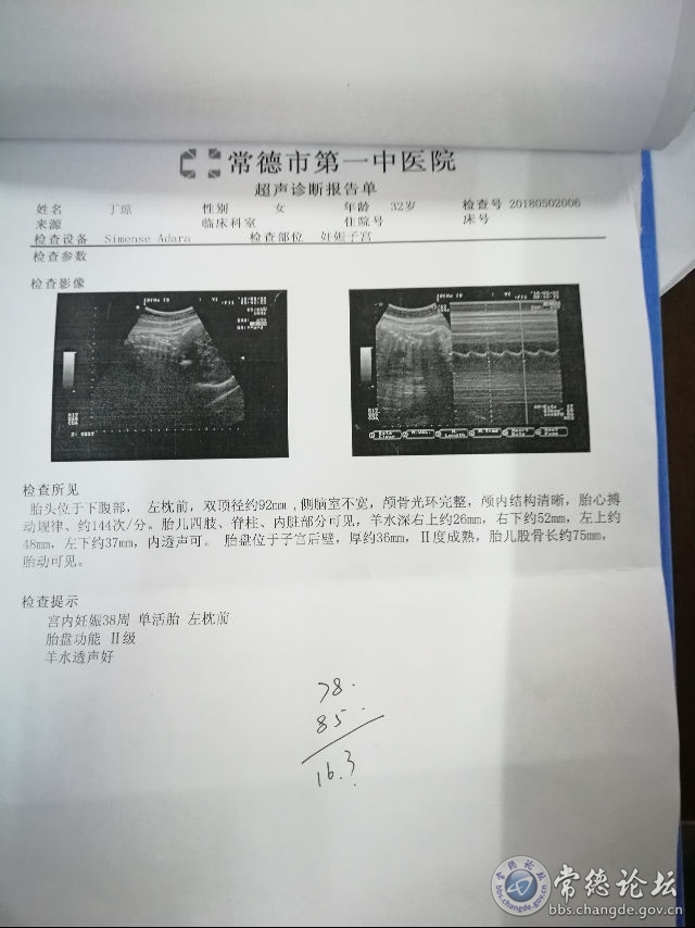 触屏版