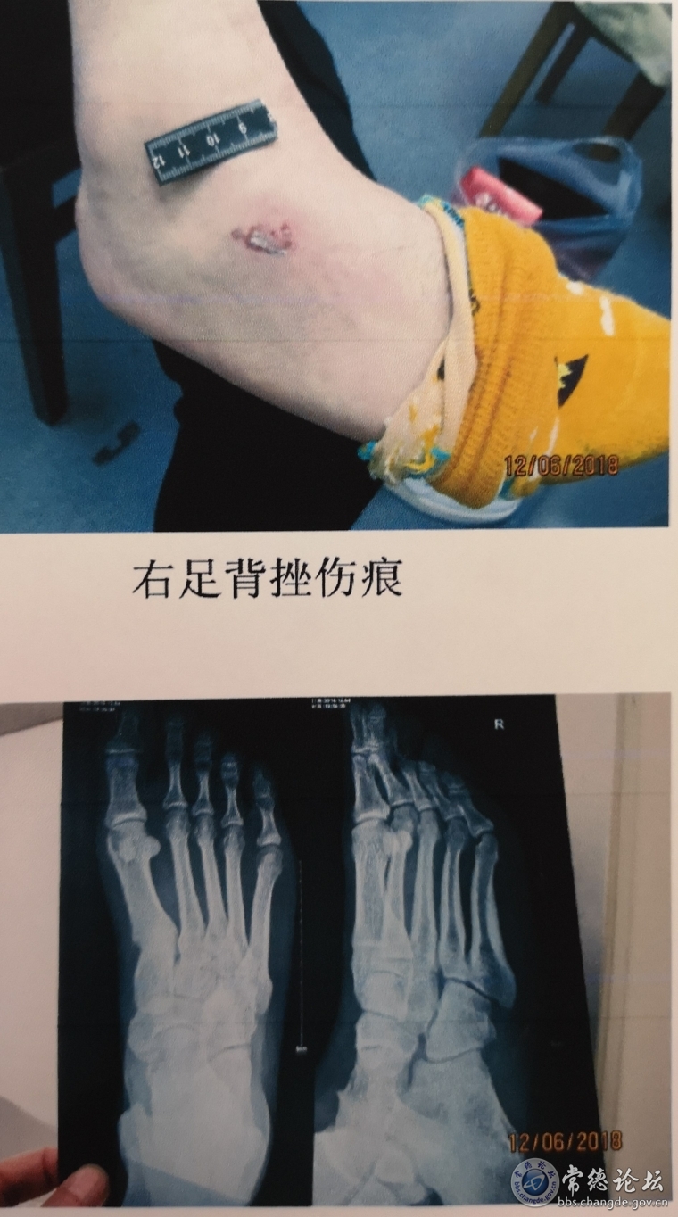 附件一3