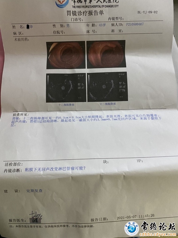 超声胃镜检查结果